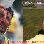 Heat Exhaustion and Heat Stroke