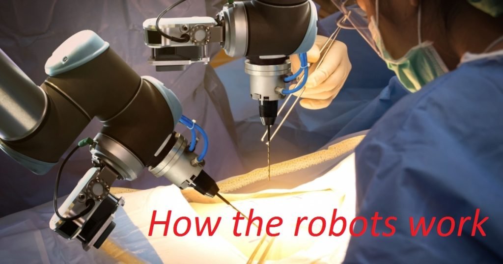 Robotic surgery