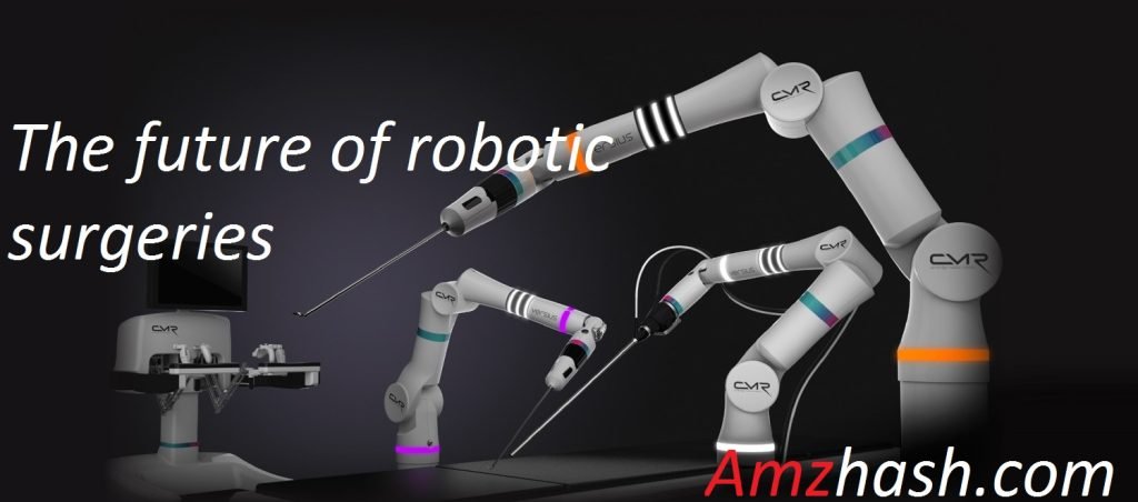 Robotic surgery